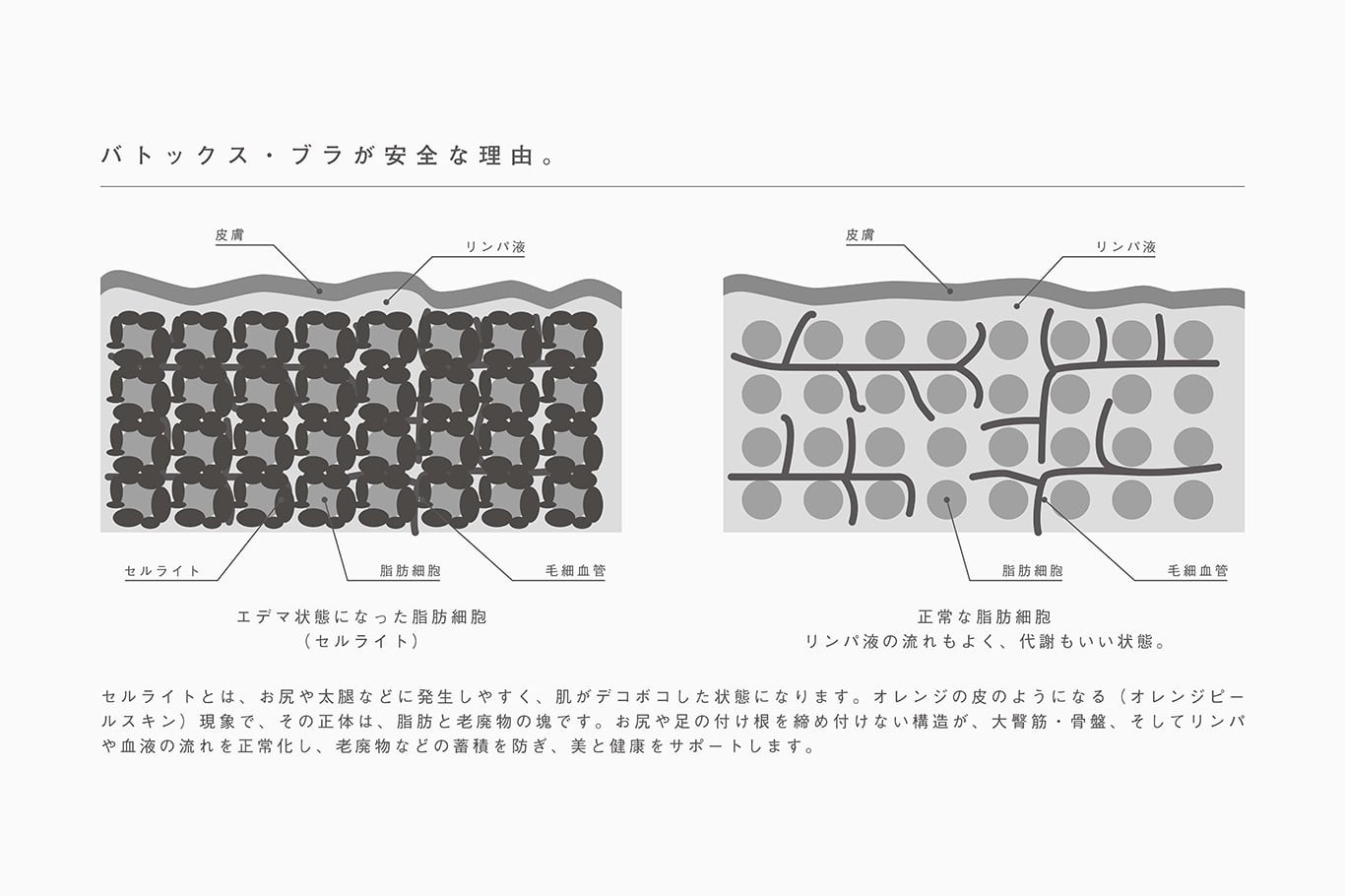バトックス・ブラ11